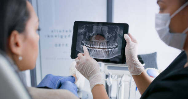 Licensed Tooth Extraction service in North Canton, OH - Smile Center Dentistry